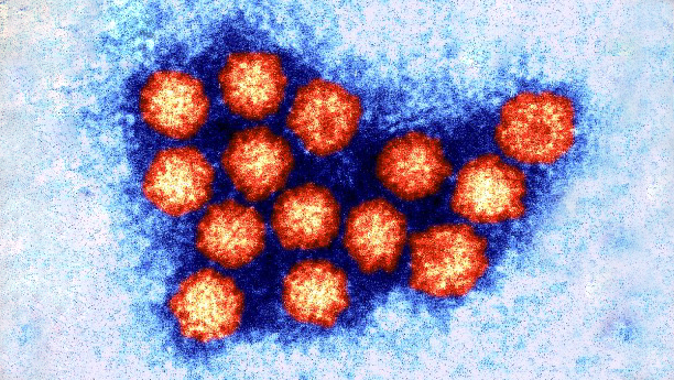 Norovirus