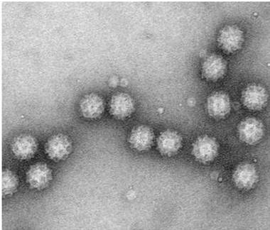 Sapovirus